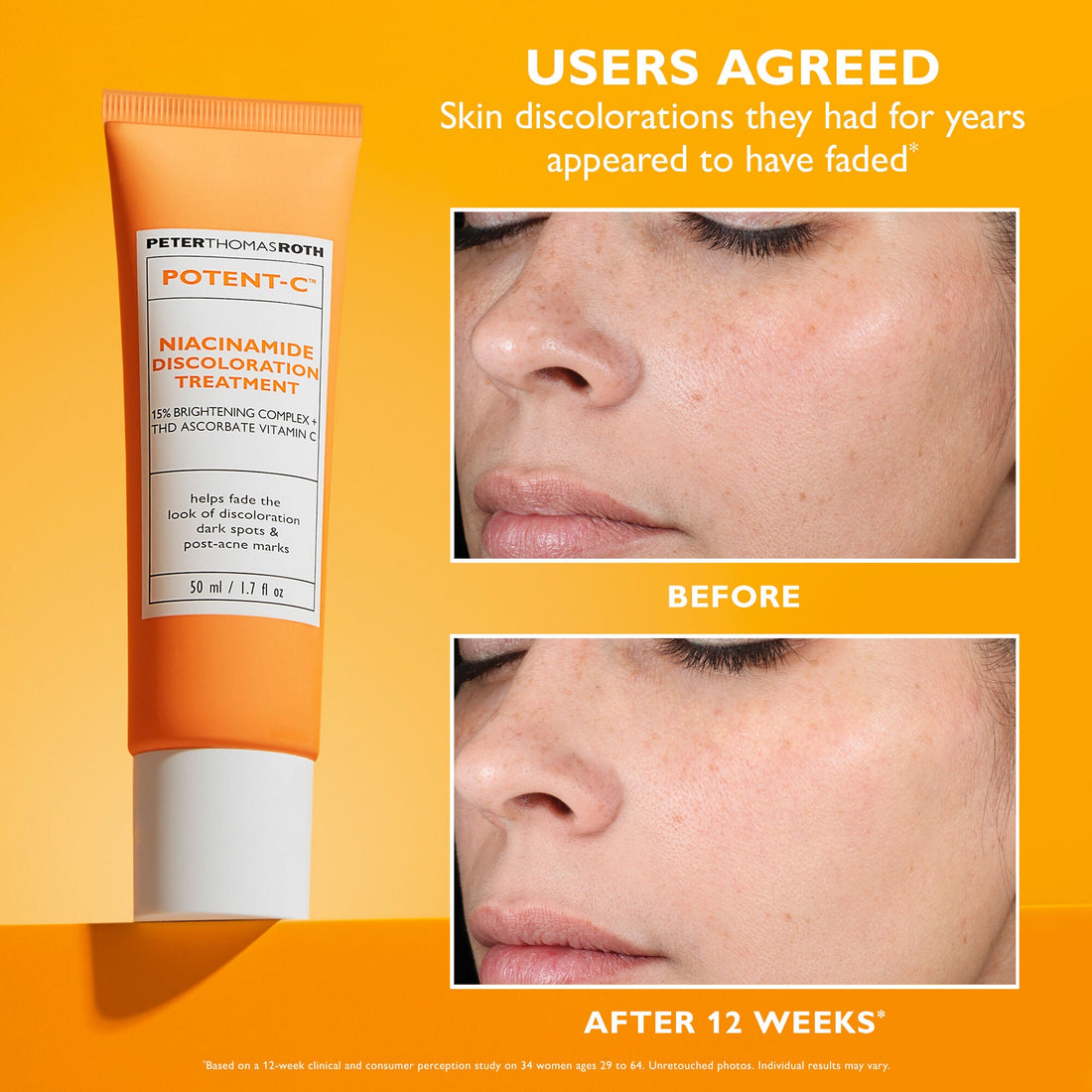 The 11 Best Dark Spot Correctors That Gave Visible Results in Our Lab Testing