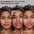Three-panel before and after showing person applying clear peeling gel to forehead and the resulting smoother skin appearance