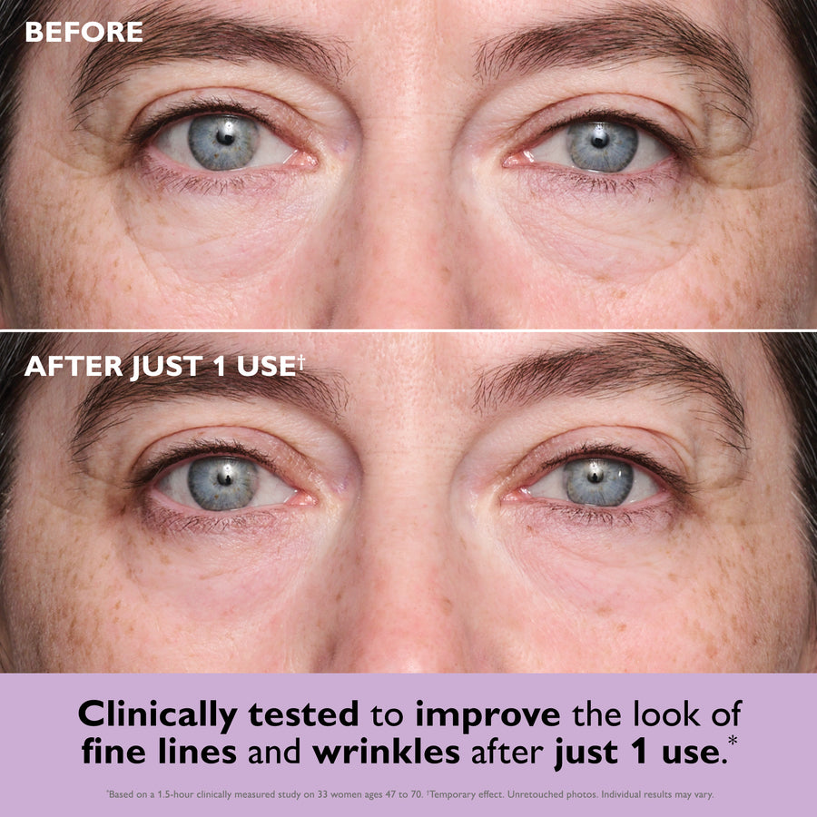 Close-up of eye area showing fine lines and under-eye skin texture before and after application of eye patches.
