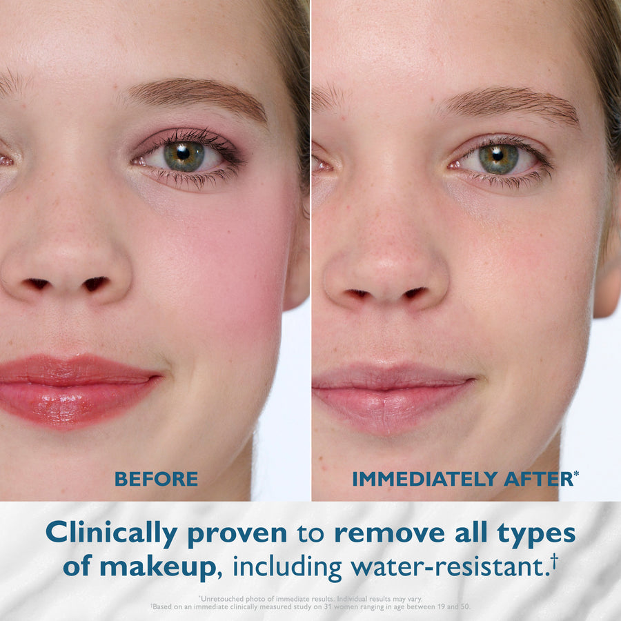 Before and after facial comparison showing reduced redness and cleaner skin on the right side.