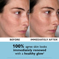 Side-by-side comparison of face showing skin texture before and after serum application, with increased luminosity on right s