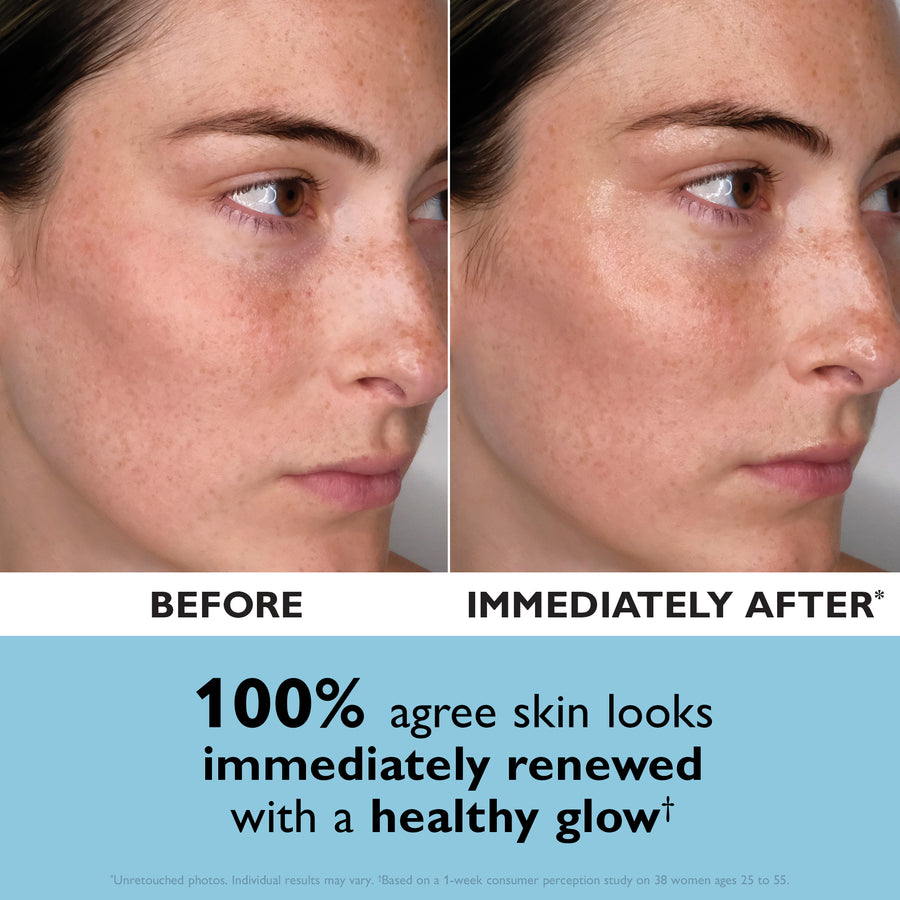 Side-by-side comparison of face showing skin texture before and after serum application, with increased luminosity on right s