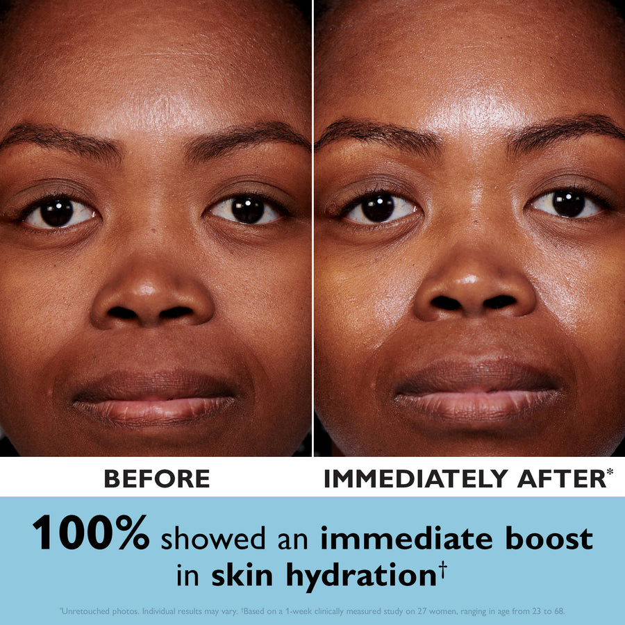 Before and after comparison showing person's face with increased skin hydration and shine on the right side.