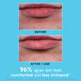 Before and after comparison of lips showing improved hydration and smoother texture after product use.
