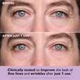 Close-up of eyes showing wrinkles and fine lines around the eye area in before and after comparison.