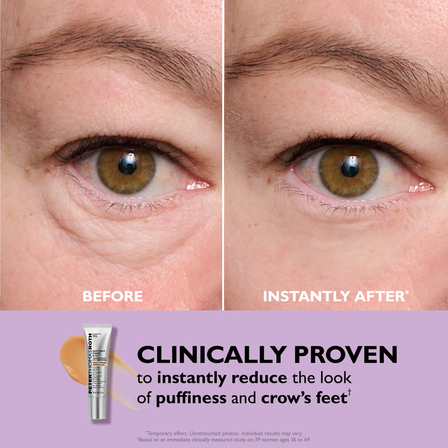 Before and after comparison of eye area showing reduced appearance of fine lines and puffiness with product tube displayed.