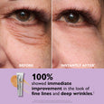 Before and after eye area showing reduced appearance of fine lines and wrinkles, with product tube displayed below.
