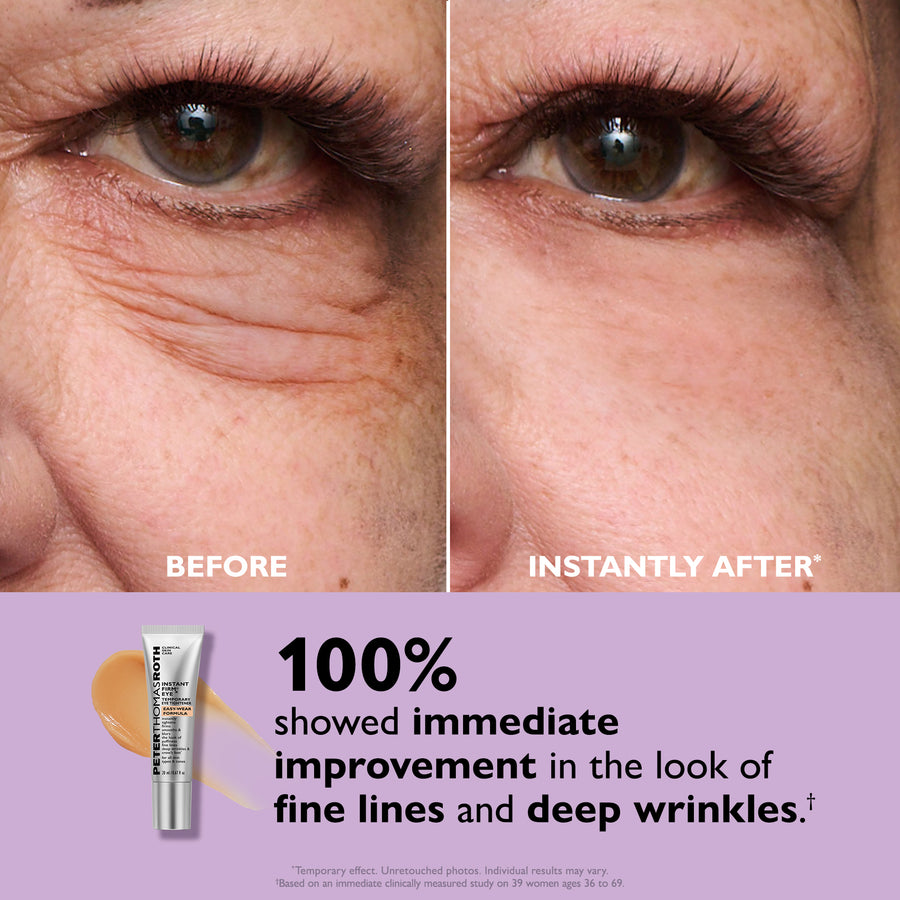 Before and after eye area showing reduced appearance of fine lines and wrinkles, with product tube displayed below.