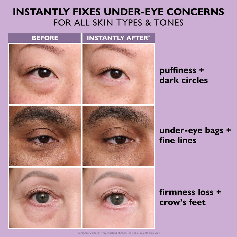 Before and after eye area close-ups showing reduced puffiness, dark circles, under-eye bags, fine lines, and crow's feet on t