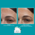 Two white jars of Peptide Skinjection cream displayed below before and after photos of facial skin showing forehead and eye a