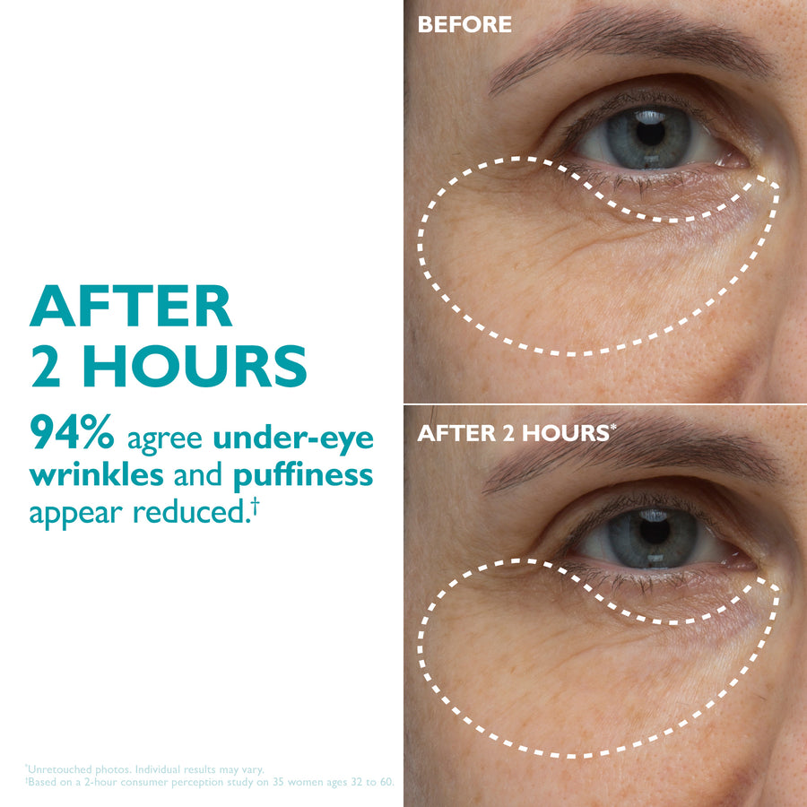 Before and after comparison of under-eye area showing application of peptide-infused face and eye tape.