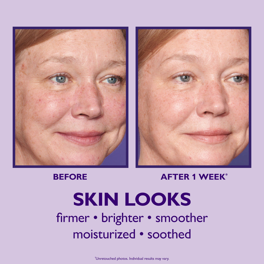 Before and after facial comparison showing reduced redness and smoother skin texture on a woman's face.