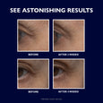Four close-up photos of eye area skin showing before and after results at 2 weeks and 4 weeks.