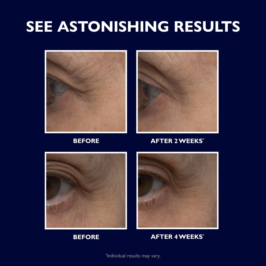 Four close-up photos of eye area skin showing before and after results at 2 weeks and 4 weeks.