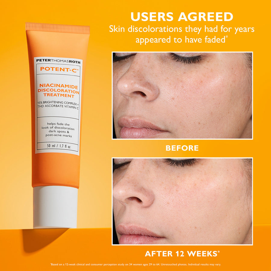 Potent-C Niacinamide Discoloration Treatment tube in orange and white, 50 ml size, on yellow background.