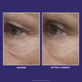 Before and after close-up of eye area showing skin texture around the eye with visible lines and wrinkles.