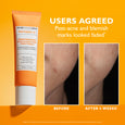 Potent-C Niacinamide Discoloration Treatment tube with orange and white packaging on yellow background.
