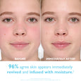 Before and after facial comparison showing skin appearance with reduced redness and increased shine on right side.