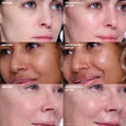 Before and after comparison of facial skin showing increased smoothness and shine on right side.
