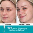 Side-by-side comparison of woman's face before and after one week, showing skin texture and appearance changes.