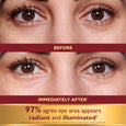 Close-up of brown eyes showing before and after appearance of eye area with text overlay stating results.