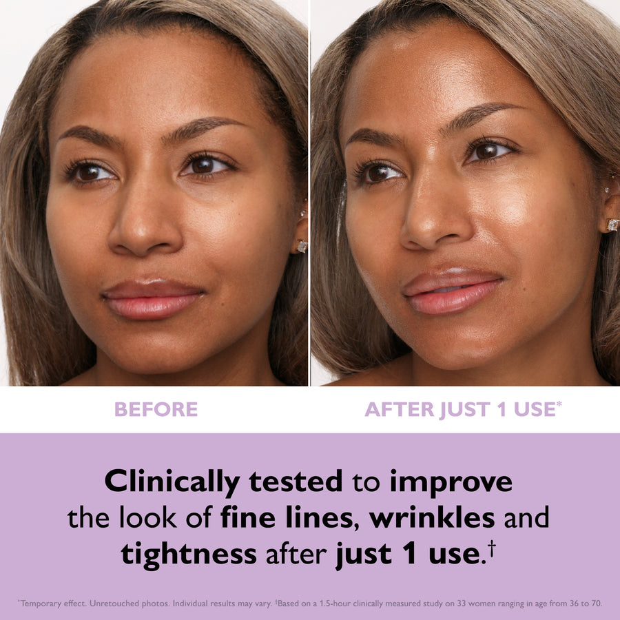 Before and after comparison of a woman's face showing skin texture around the eye and cheek area.