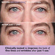Close-up of person's eyes showing under-eye area before and after eye patch application.
