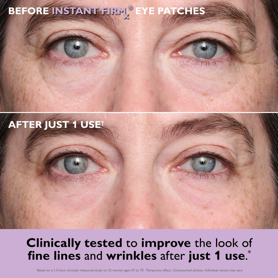 Close-up of person's eyes showing under-eye area before and after eye patch application.