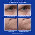 Before and after comparison of eye area and chin showing fine lines and wrinkles on blue background.